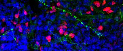  Stem cells - copyright Joseph Elsbernd @ Flickr