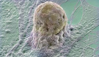 Human Emryonic Stem cell -- Copyright Annie Cavanagh. Wellcome Images on Flickr