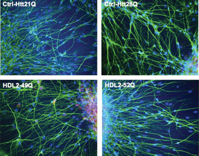 The role of junctophili-3 (JPH3) in neurons- comparison to chorein (VPS13A)