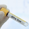 A lab vial labelled DNA test